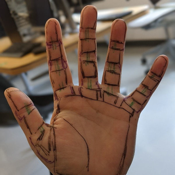 Prosthetic Hand Concept
